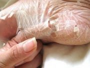 Namazala jsem si tuto přísadu na své hrubé paty a byla jsem v šoku: Moje kůže je jemná jako miminko, trik, který mě zachránil před nevzhlednými a popraskanými patami!