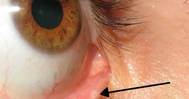 0802eyefeatured-696x365