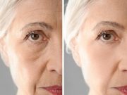 POKUD TO UDĚLÁTE, NEBUDETE MÍT NA TVÁŘI ŽÁDNÉ VRÁSKY: Trik, na který dermatologové přísahají, VŠECHNY ŽENY NADŠENÉ