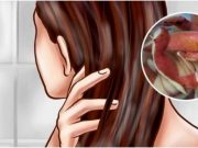 BUDE VÁM LÍTO, ŽE JSTE TO NEVĚDĚLI DŘÍVE: Uvařila bramborovou slupku a vyřešila jeden z největších problémů žen