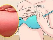 Zde se dozvíte, co znamená svědění jednoho nebo obou prsů a kdy MUSÍTE NAVŠTÍVIT lékaře