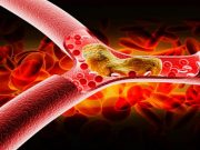 POKUD NEVÍTE, JESTLI MÁTE VYSOKÝ CHOLESTEROL, PODÍVEJTE SE NA SVÉ NOHY: Nemusíte chodit na krev, to je hlavní znamení