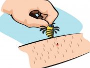 TOTO JSOU ZNÁMKY, ŽE JSTE ALERGIČTÍ NA VČELÍ žihadla: Pokud na svém těle zaznamenáte tyto změny, okamžitě kontaktujte svého lékaře!