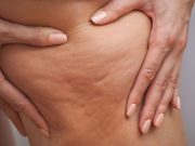 ZNIČÍ AŽ 90 % CELULITIDY – NEJSILNĚJŠÍ SMĚS: Její příprava je snadná a doslova zničí NEJVĚTŠÍ NOČNÍ MŮRU VŠECH ŽEN