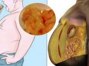 TOHLE VYPIJTE KAŽDÉ RÁNO PŘED SNÍDANÍ A PŮL HODINY PŘED SPANÍM: Břišní tuk během okamžiku zmizí (RECEPT)