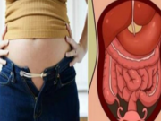 MNOHO LIDÍ DĚLÁ CHYBU, ŽE SI MYSLÍ, ŽE JSOU TLUSTÍ, ALE TADY JE TO, O CO TO SKUTEČNĚ JDE: Tady je důvod, proč je vaše břicho velké