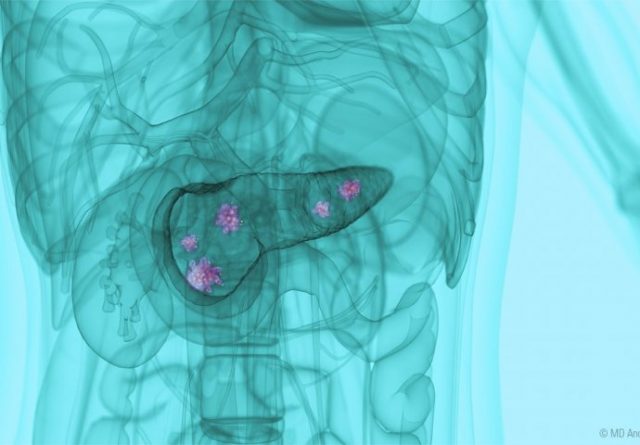 63a2b8f6-668c-4e88-8918-430b0a0a0a64-pancreas-xray-teal-jpg-resize-690x480