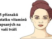 5 příznaků nedostatku vitamínů napsaných na vaší tváři – stačí se při čtení tohoto článku podívat do zrcadla